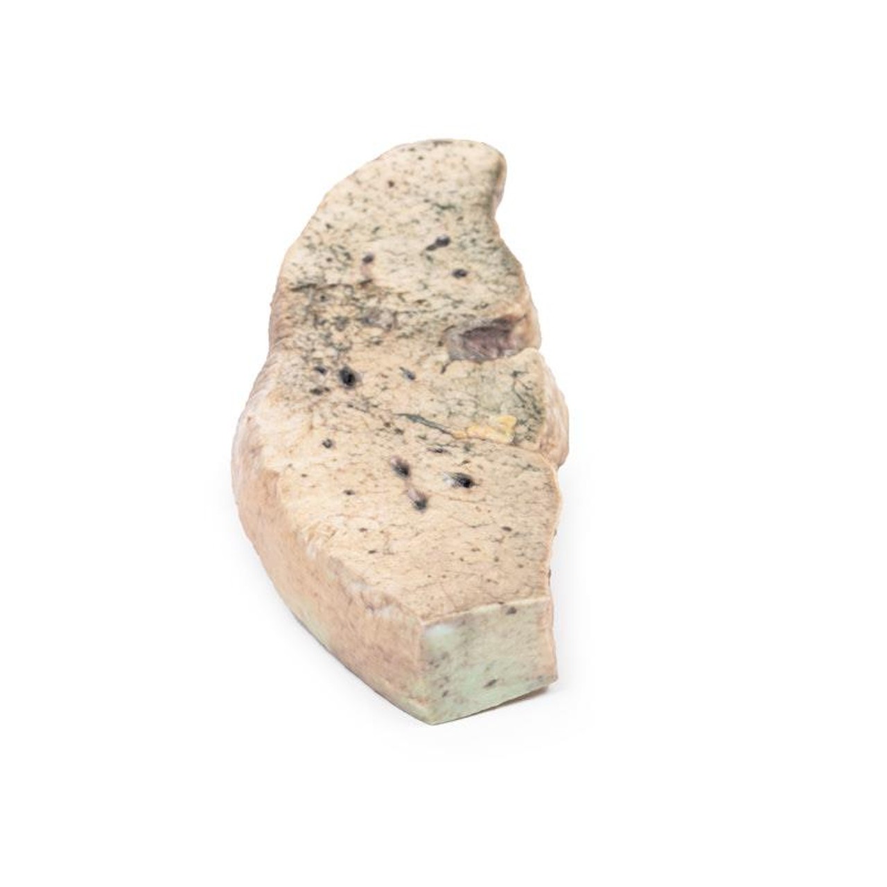 3D Printed Liver Cirrhosis