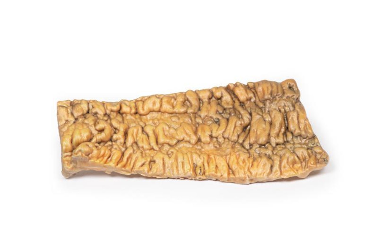 3D Printed Ulcerative Colitis