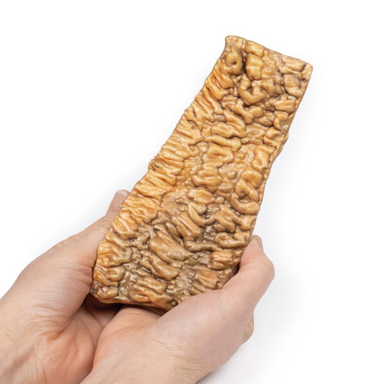 3D Printed Ulcerative Colitis