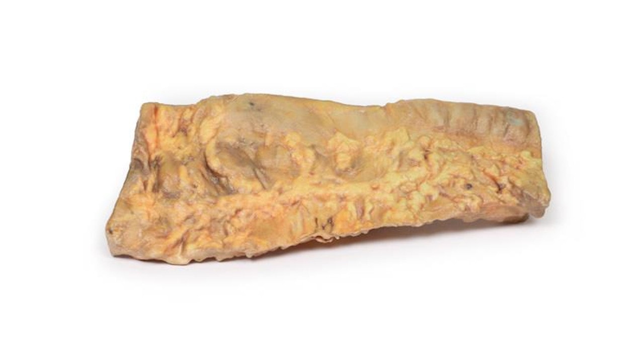 3D Printed Ulcerative Colitis