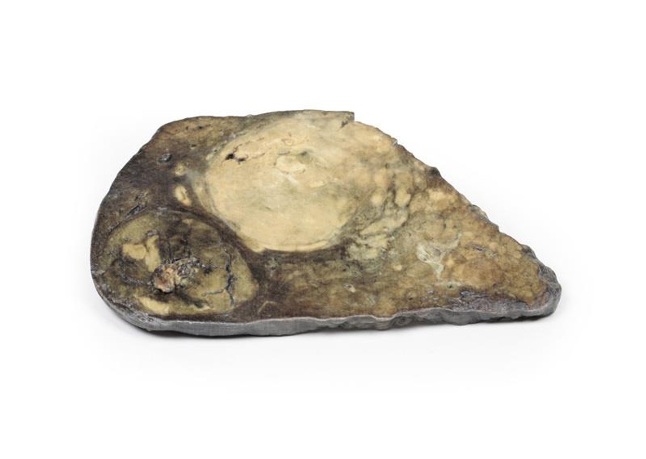 3D Printed Hepatocellular Carcinoma