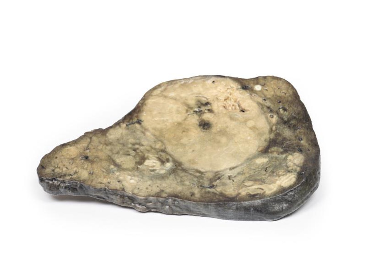 3D Printed Hepatocellular Carcinoma