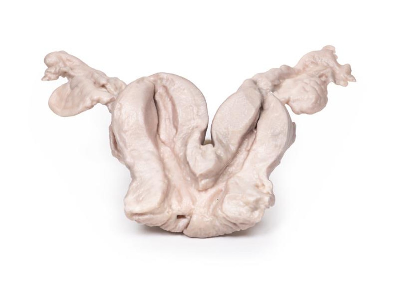 3D Printed Uterus Bicornuate Unicollis