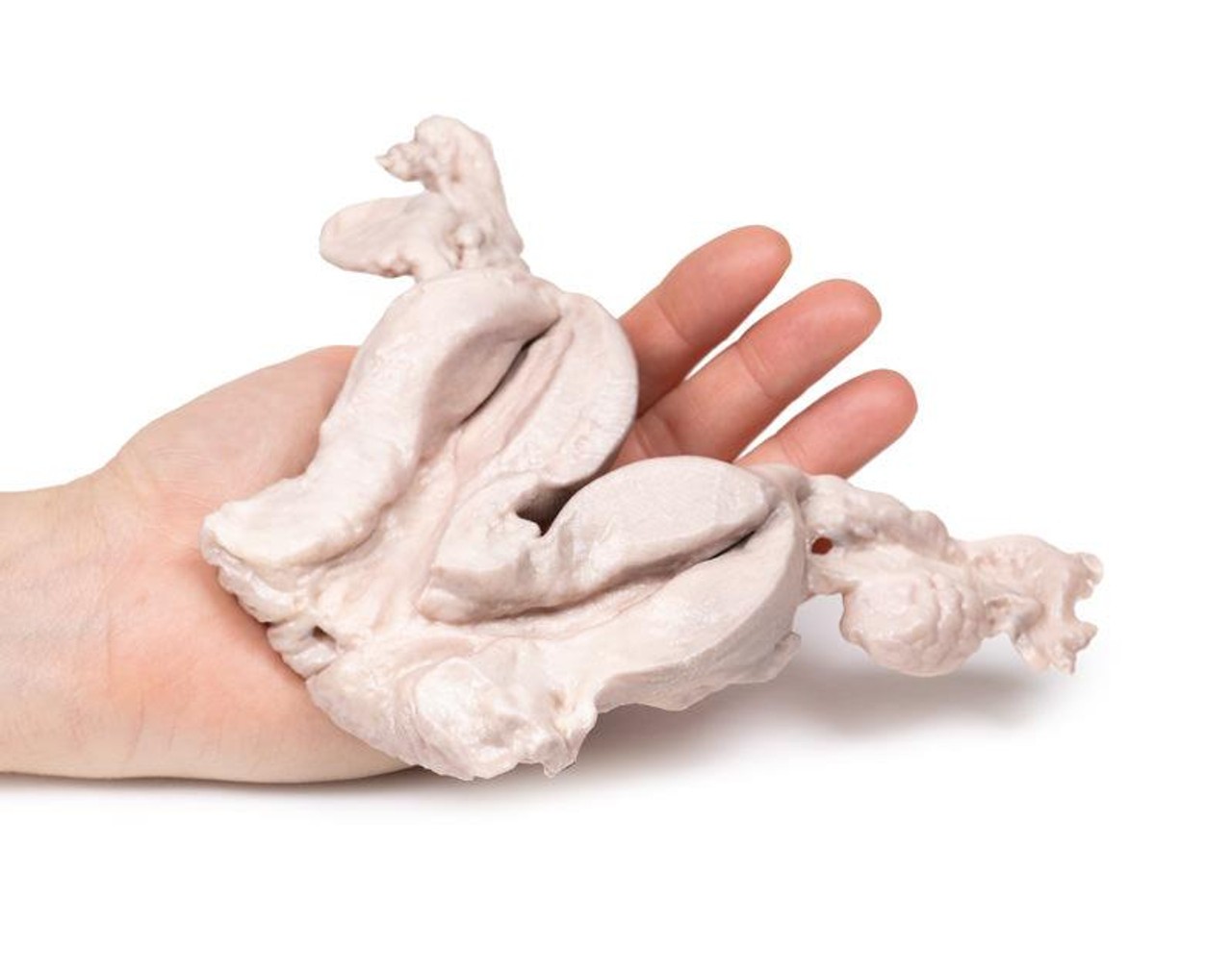 3D Printed Uterus Bicornuate Unicollis