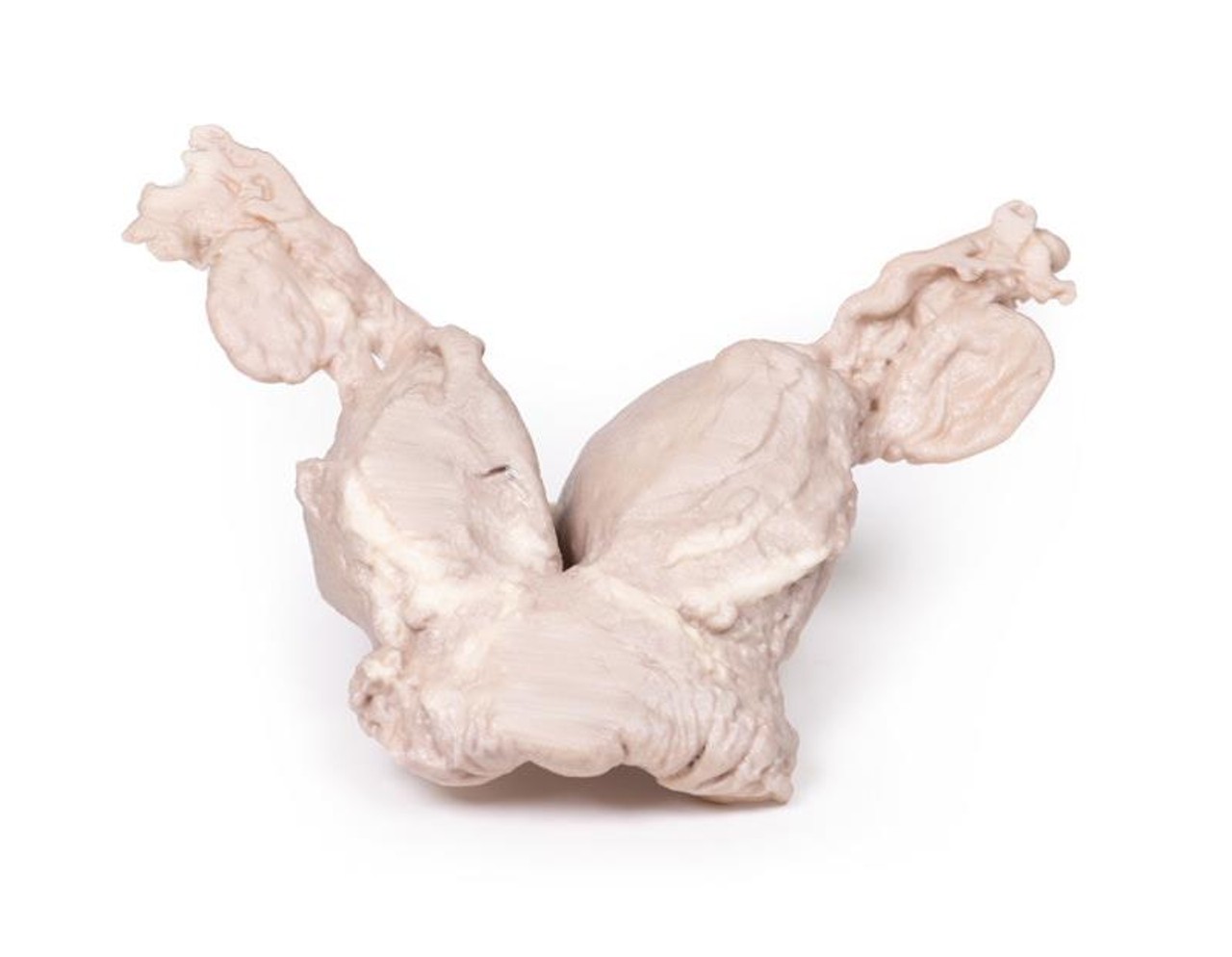 3D Printed Uterus Bicornuate Unicollis