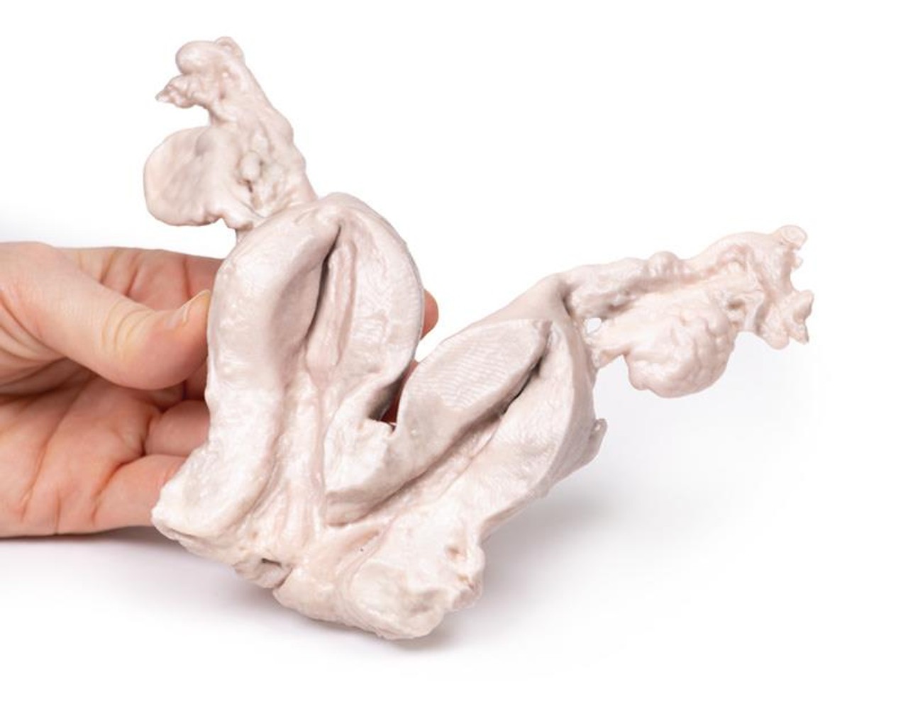 3D Printed Uterus Bicornuate Unicollis