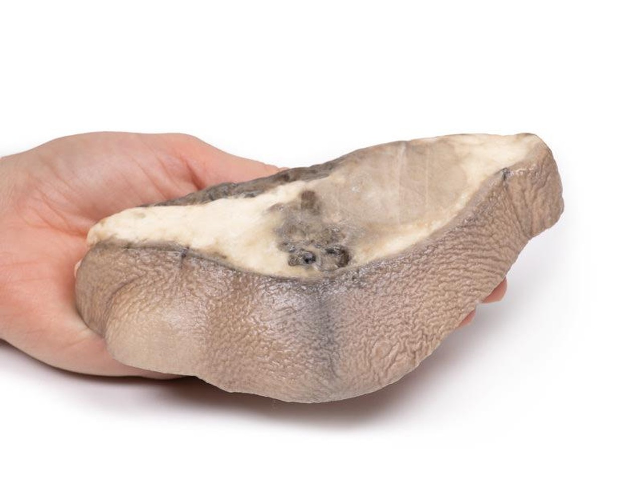 3D Printed Carcinoma of Breast
