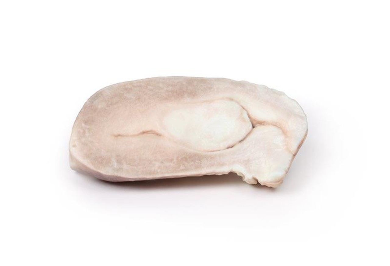 3D Printed Uterine Leiomyoma