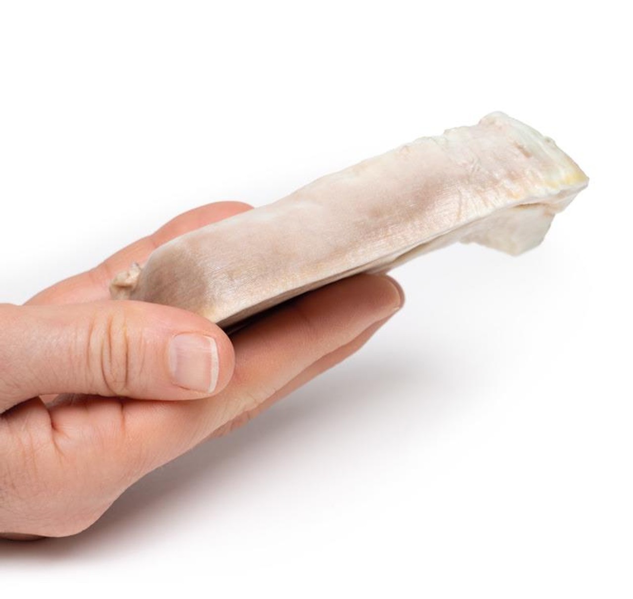 3D Printed Uterine Leiomyoma