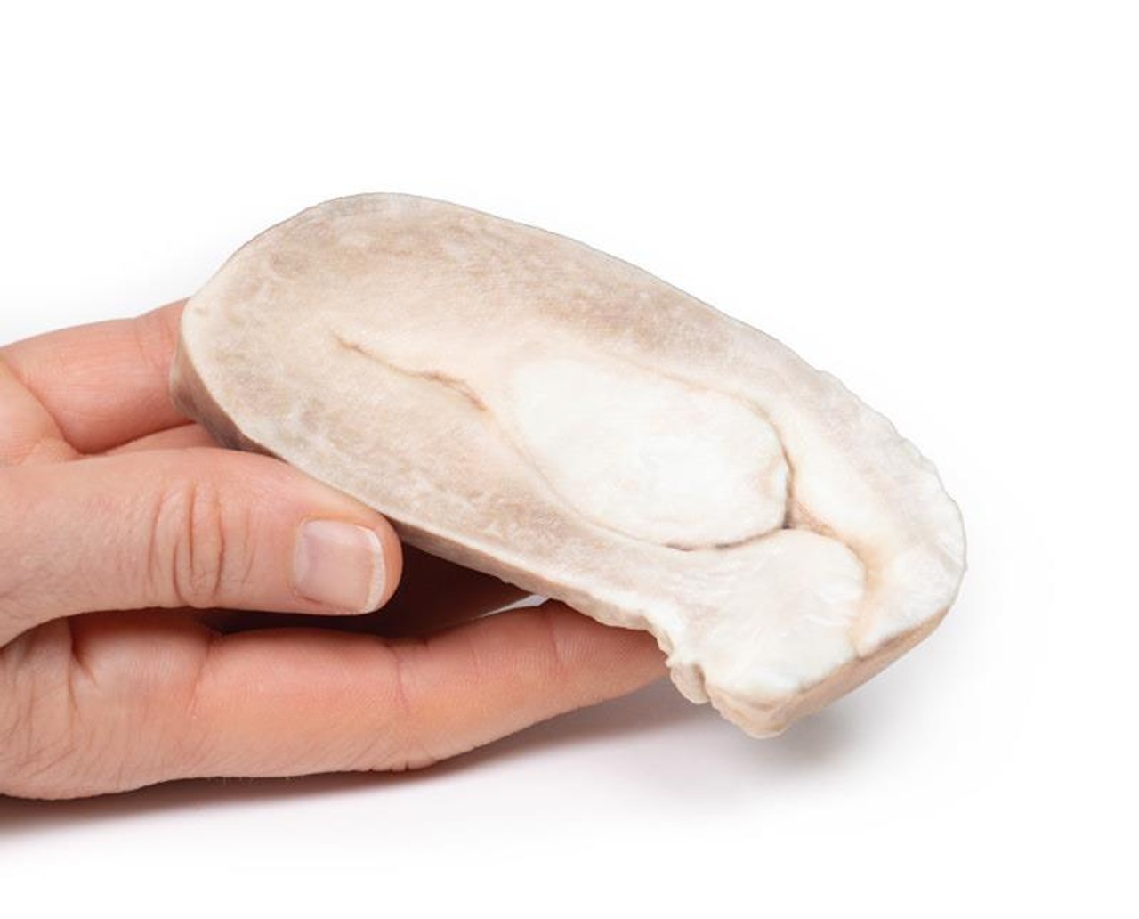 3D Printed Uterine Leiomyoma