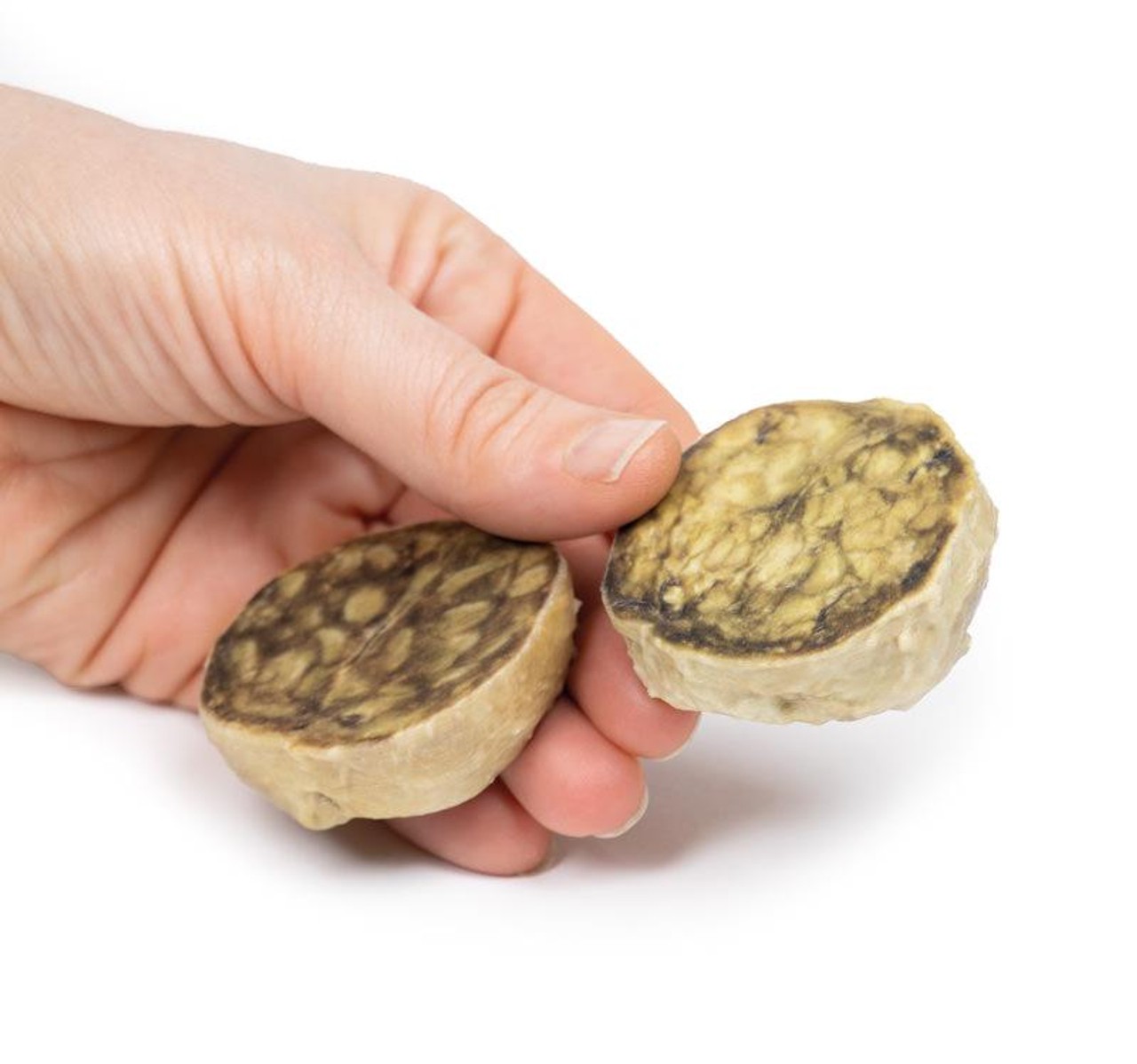 3D Printed Nodular Hyperplasia of the Prostate
