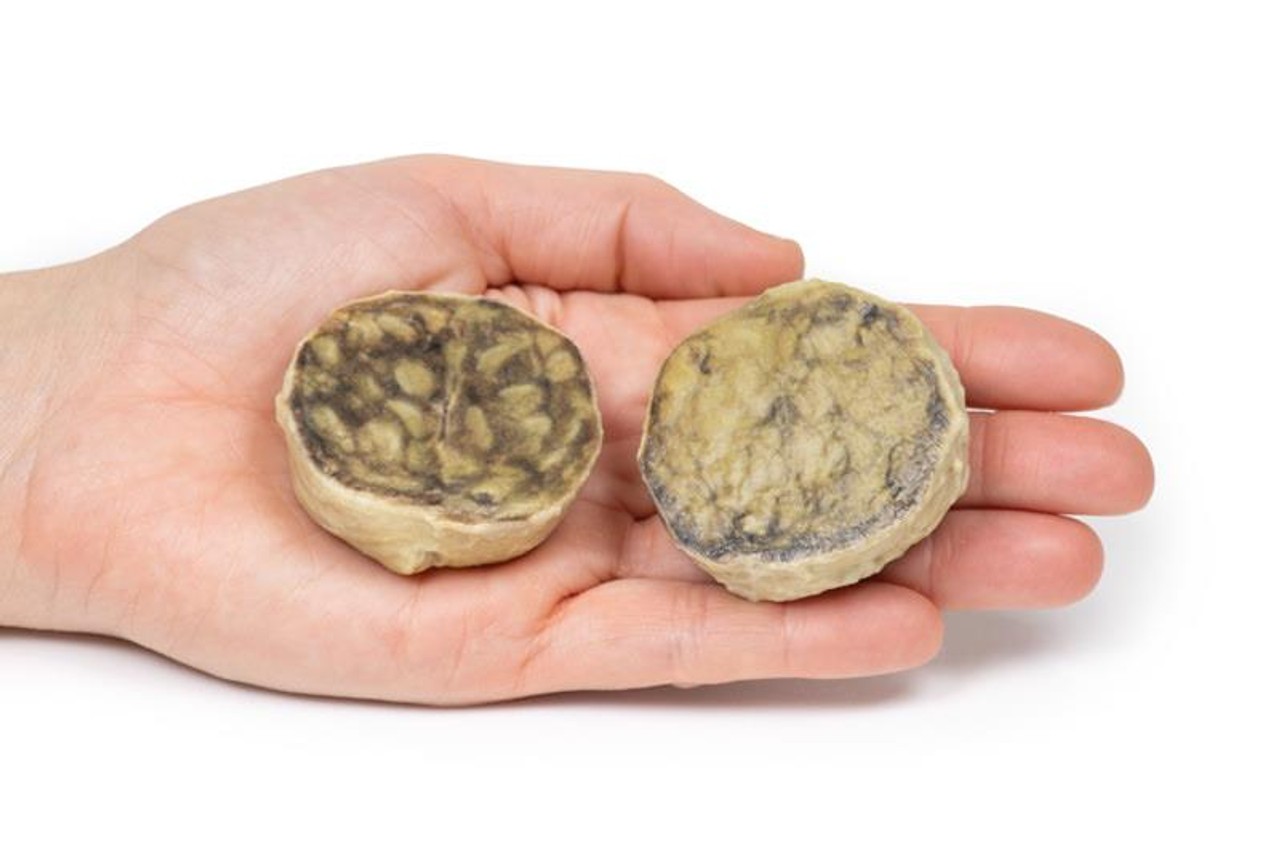 3D Printed Nodular Hyperplasia of the Prostate