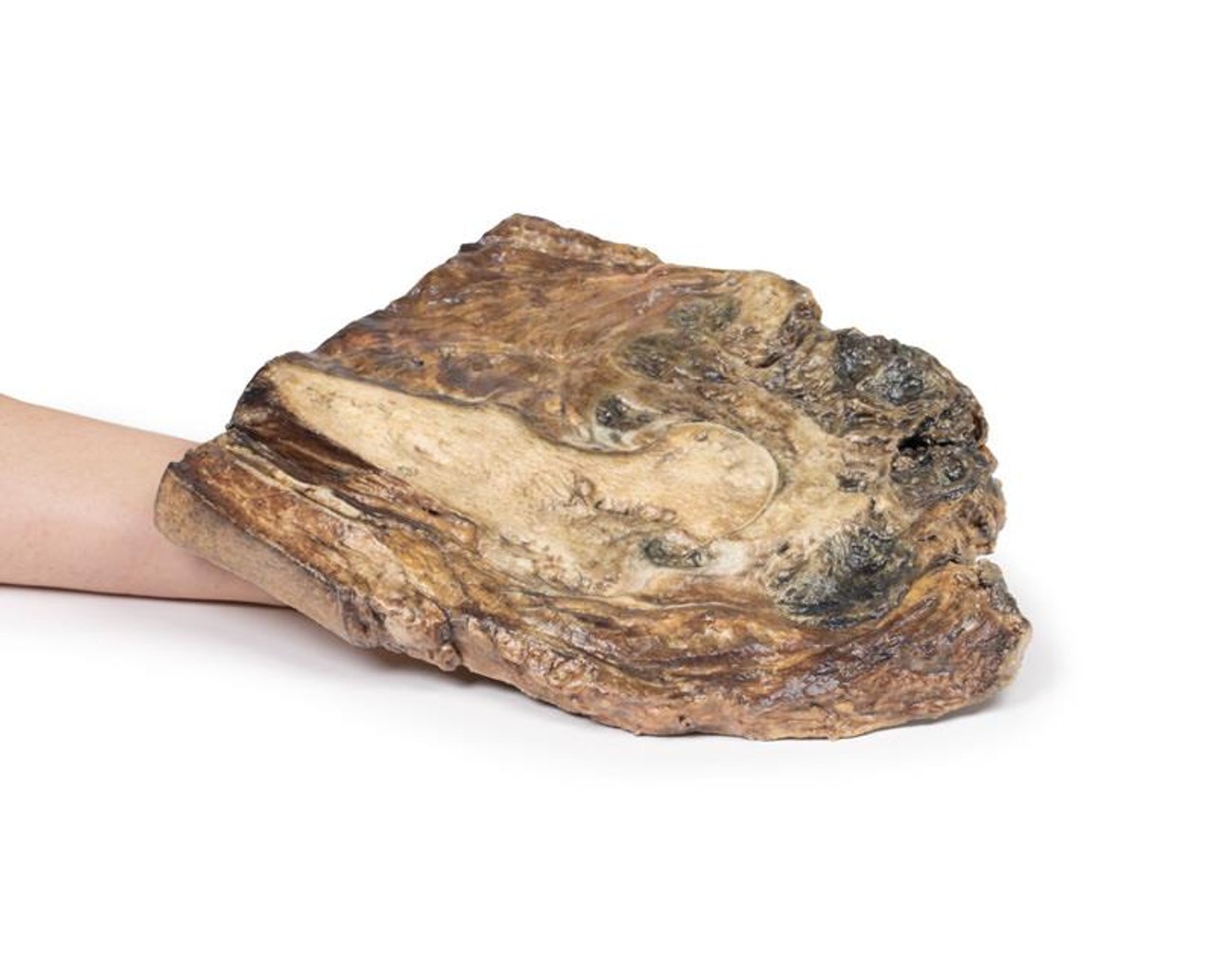3D Printed Chondrosarcoma of Femur and Ilium