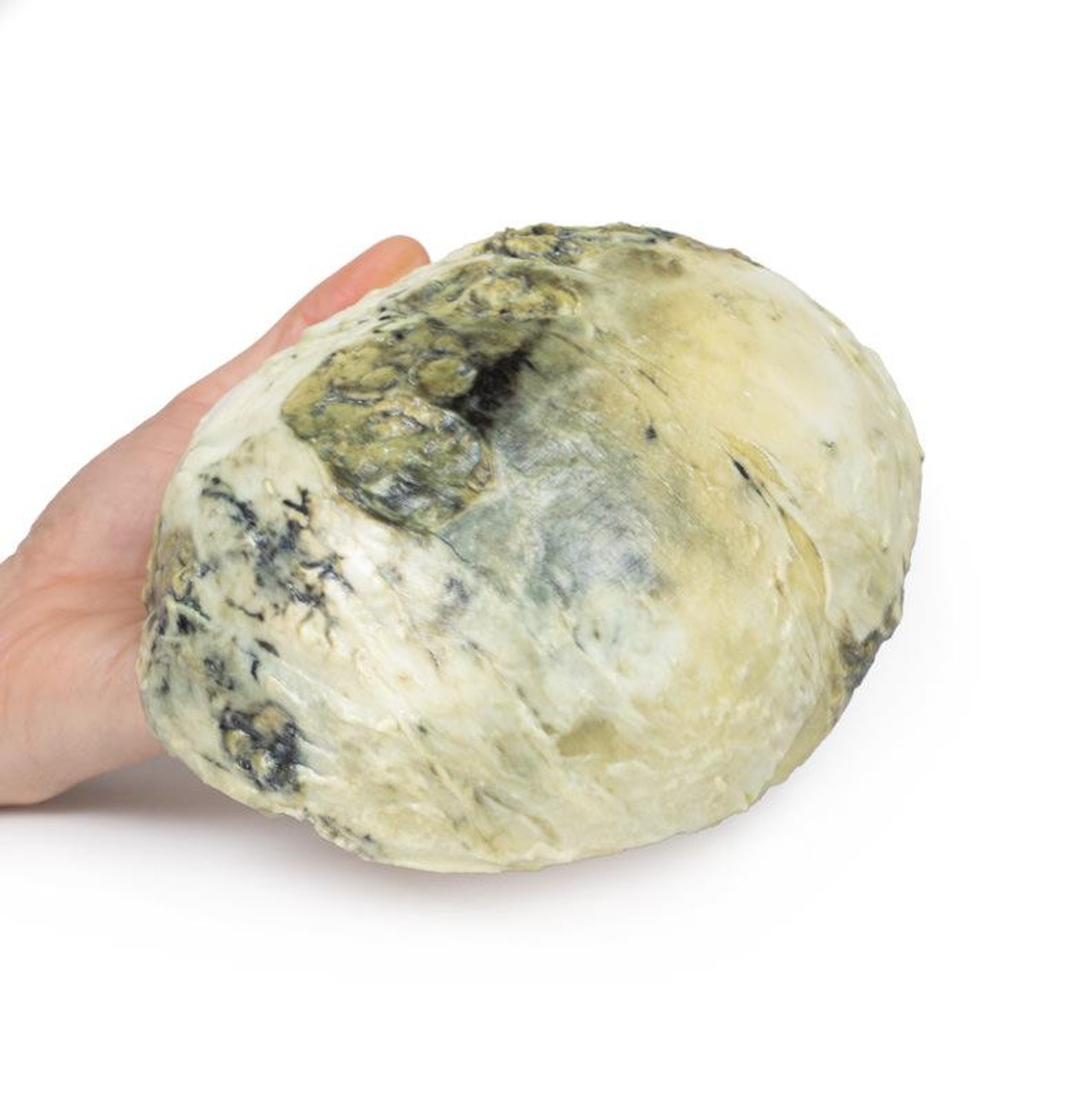 3D Printed Tertiary Syphilis