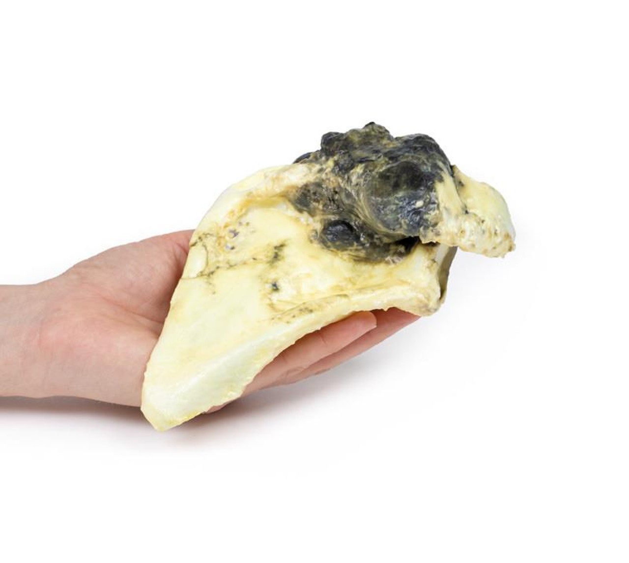 3D Printed Chondrosarcoma of Scapula