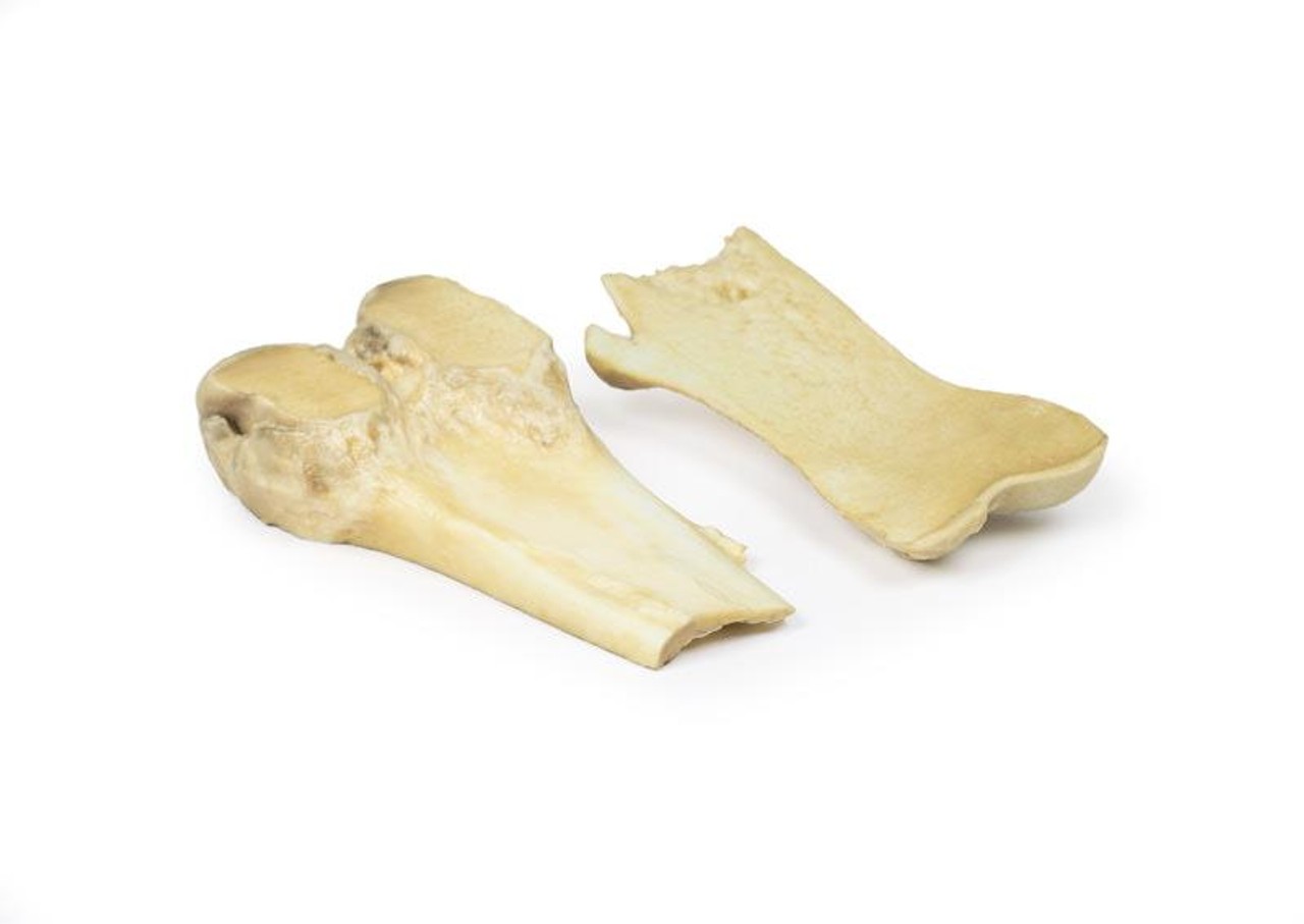 3D Printed Osteochondroma