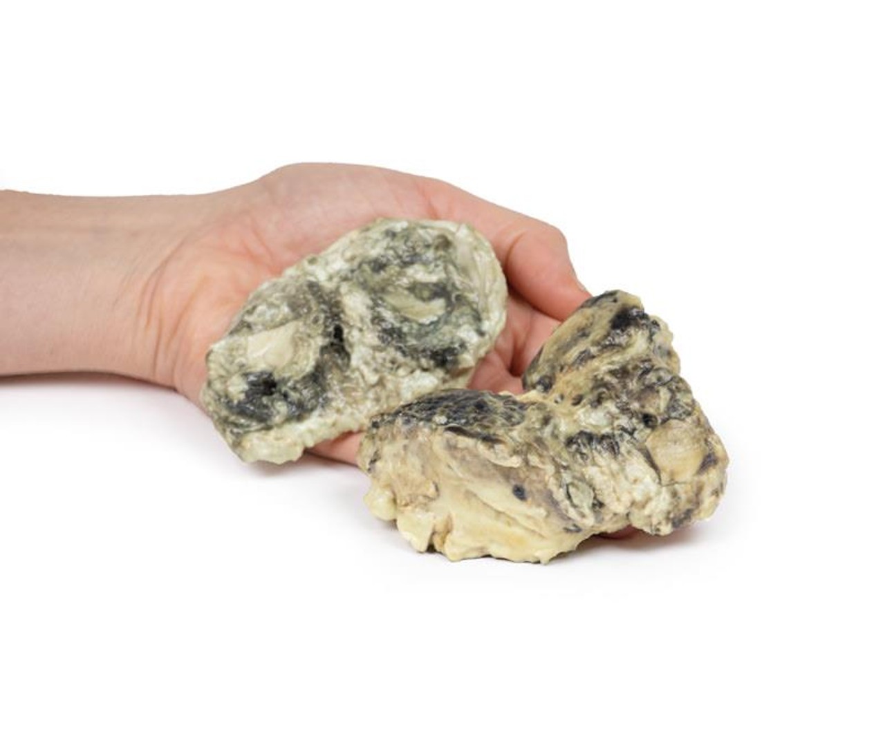 3D Printed Suppurative Arthritis of the Knee
