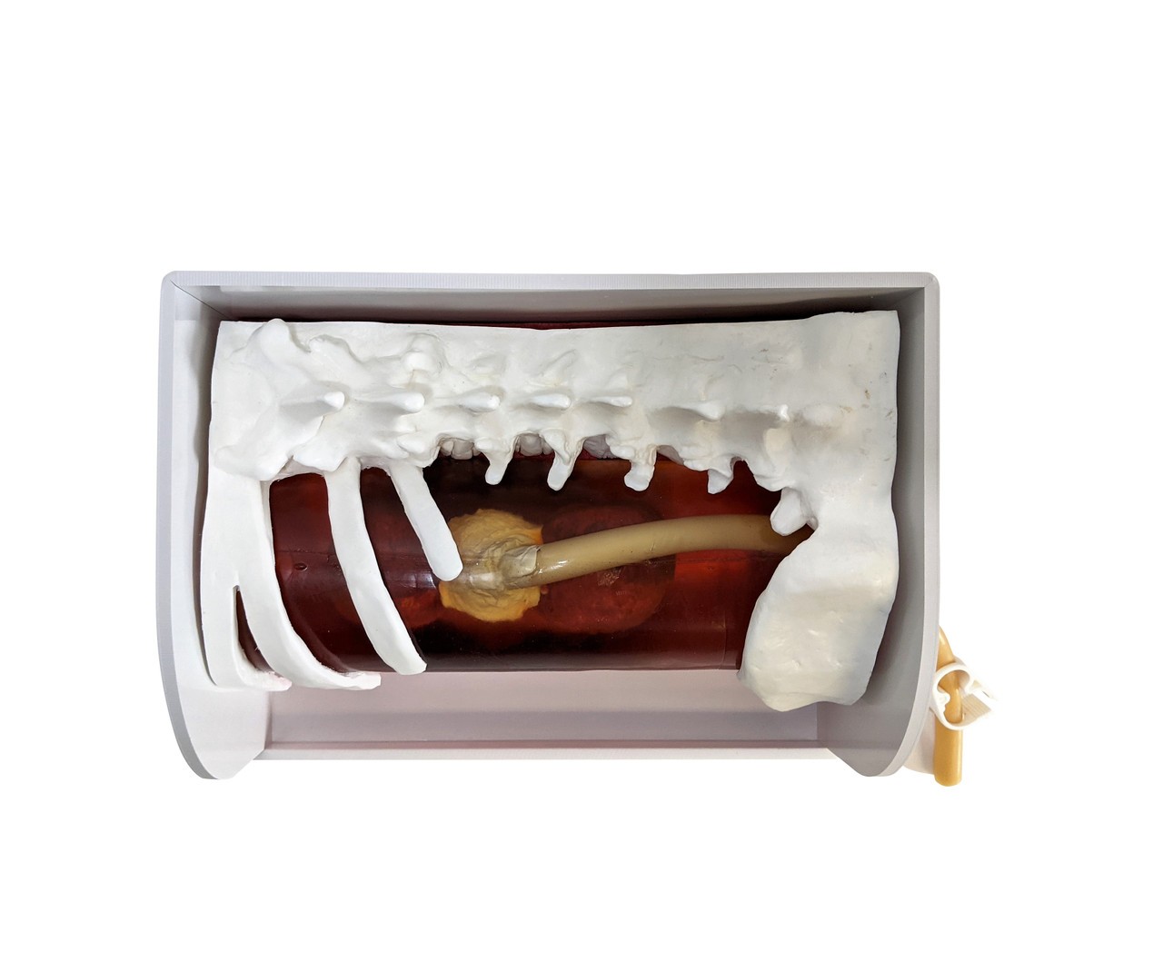 Encoris PCNL Kidney Training System Model with Case