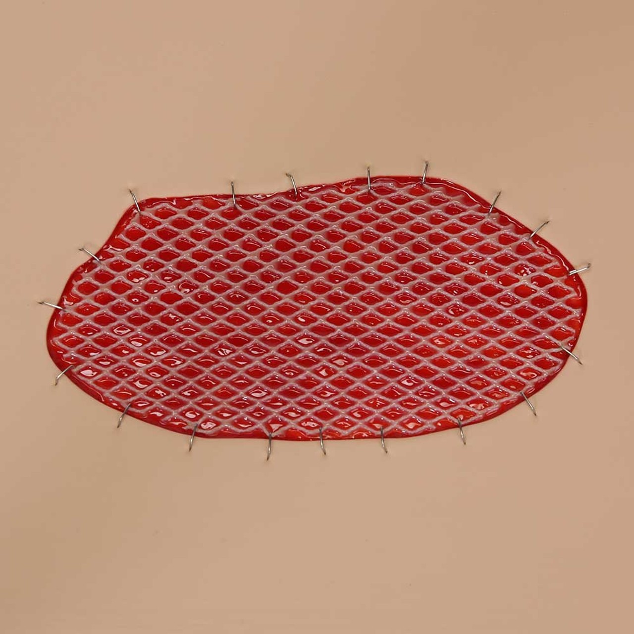 Skin Graft Wound Board
