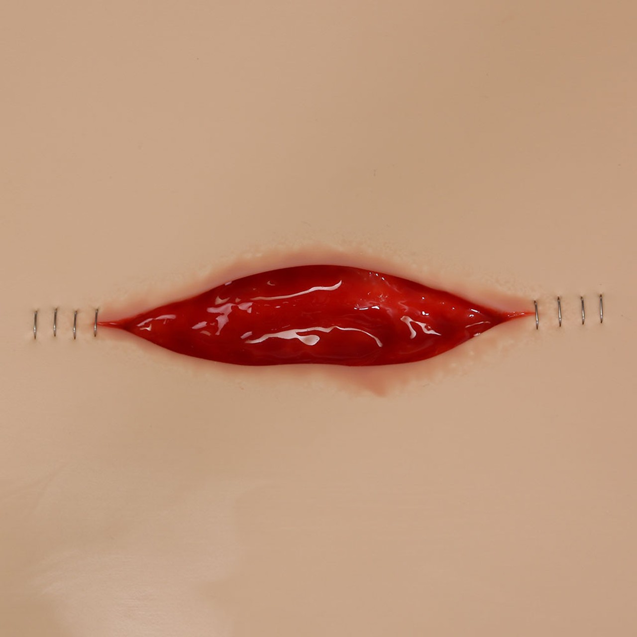 Dehisced Wound Board