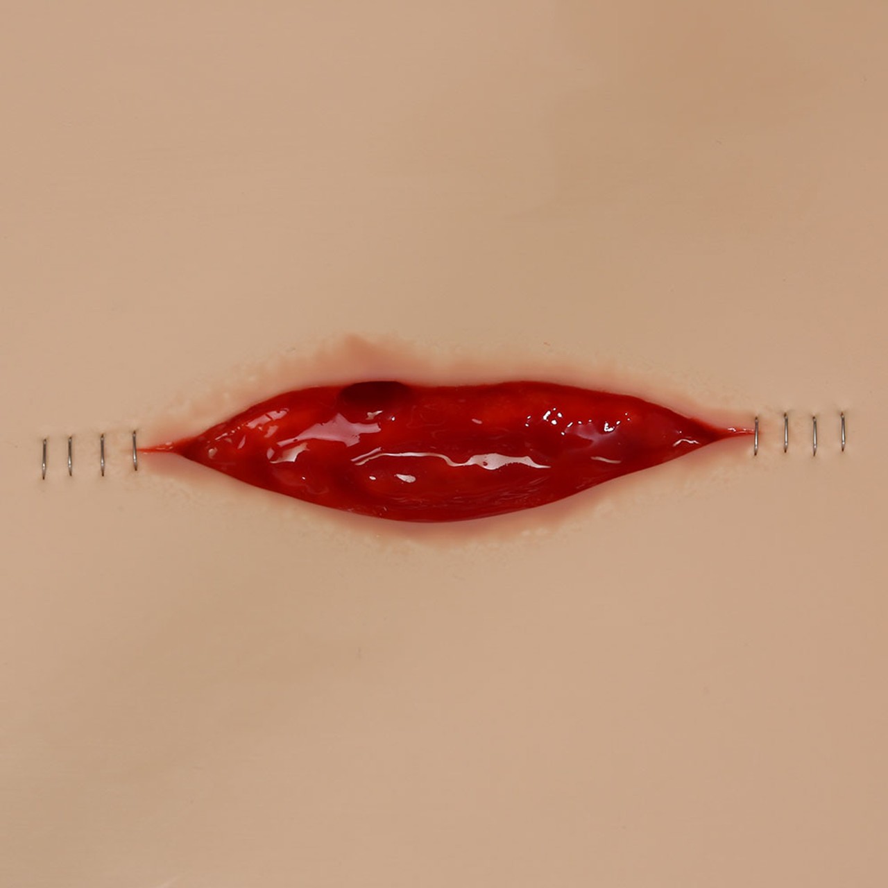 Dehisced Wound Board
