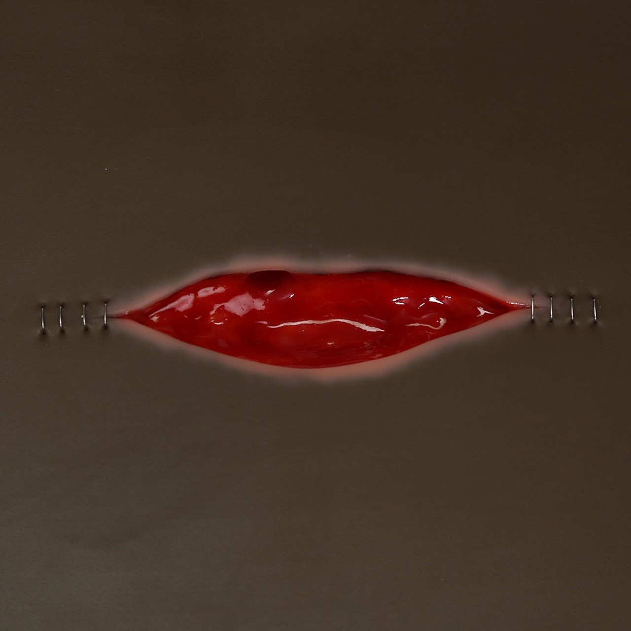 Dehisced Wound Board