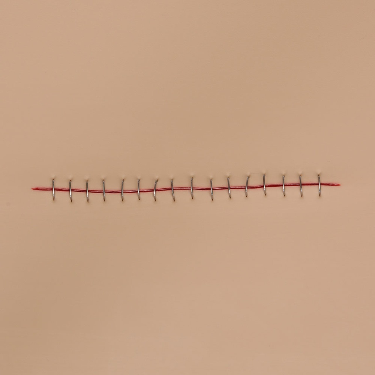 Stapled Incision Wound Board