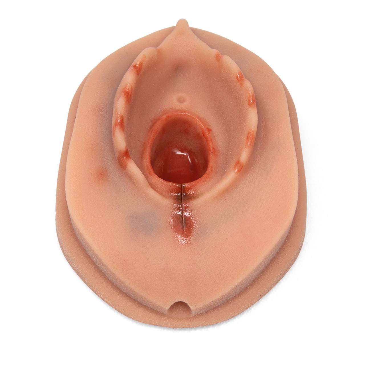 Episiotomy Suture Training Module for 3B Birthing Simulator, Light Skin