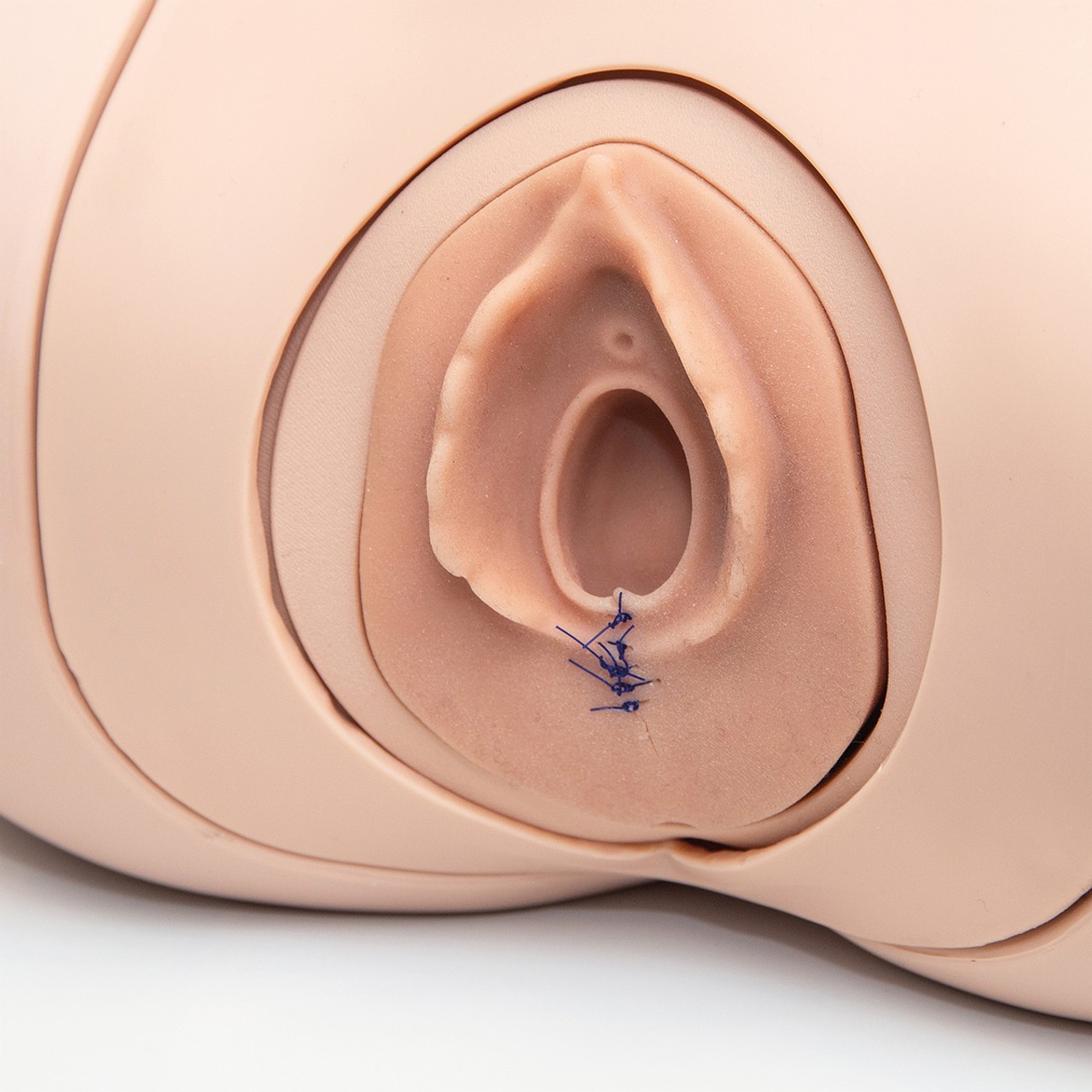 Episiotomy Suture Training Module for 3B Birthing Simulator, Light Skin