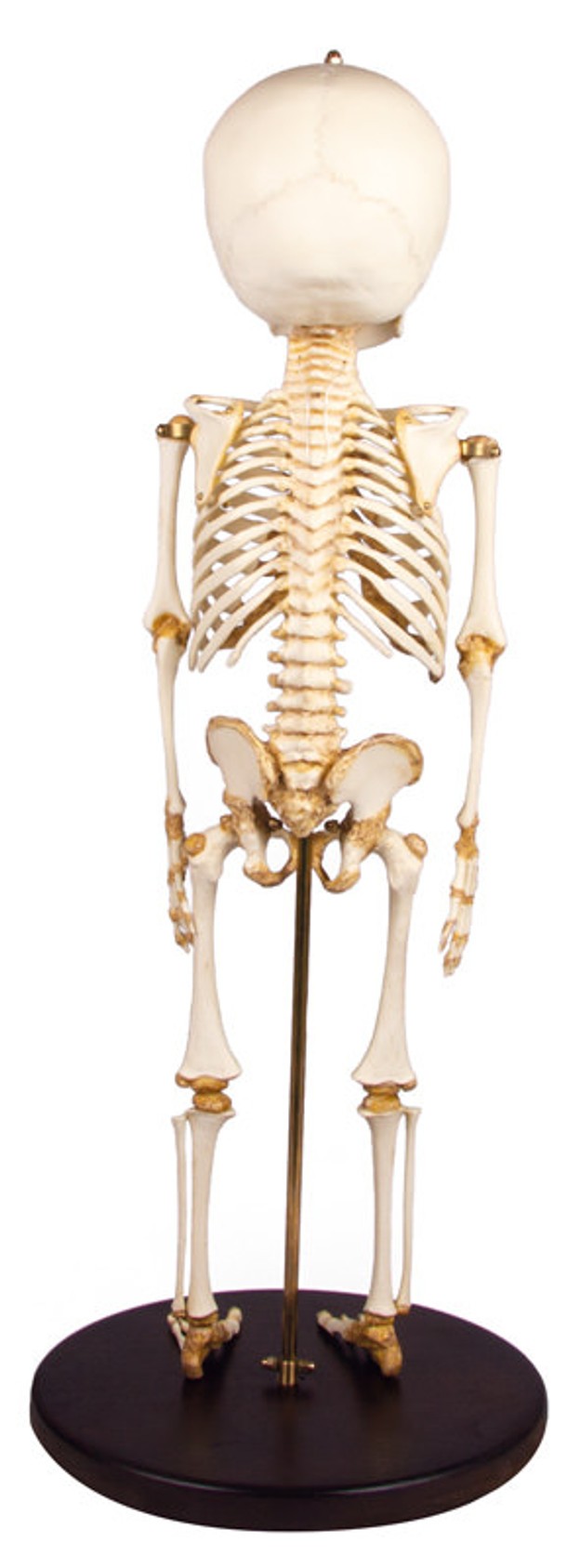 14 to 16-Month Old Child Skeleton