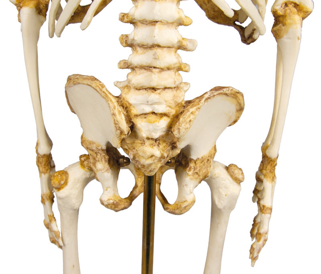 14 to 16-Month Old Child Skeleton