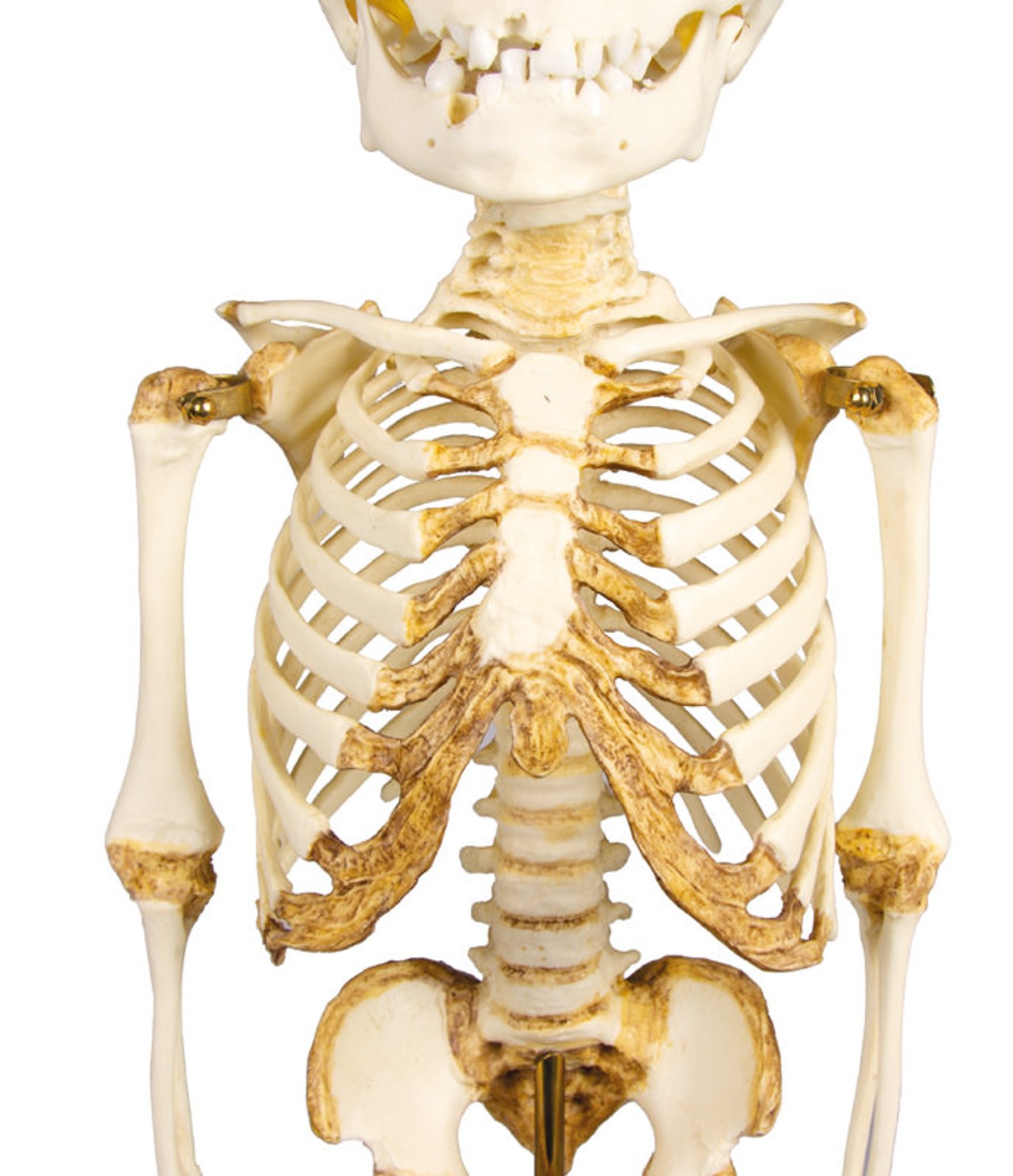 14 to 16-Month Old Child Skeleton