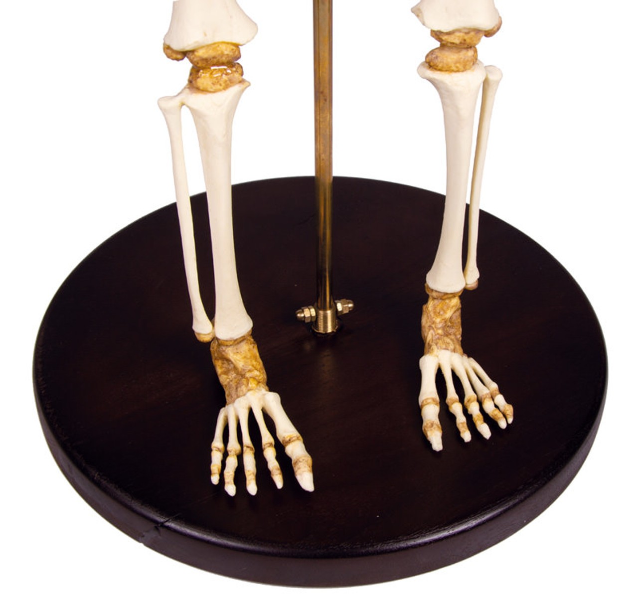 14 to 16-Month Old Child Skeleton
