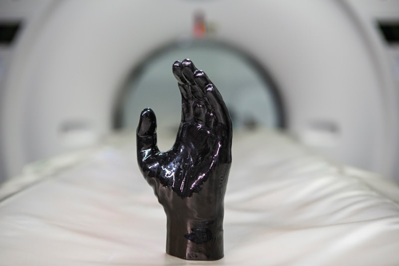 Hand Phantom for CT, X-Ray and Radiation Therapy