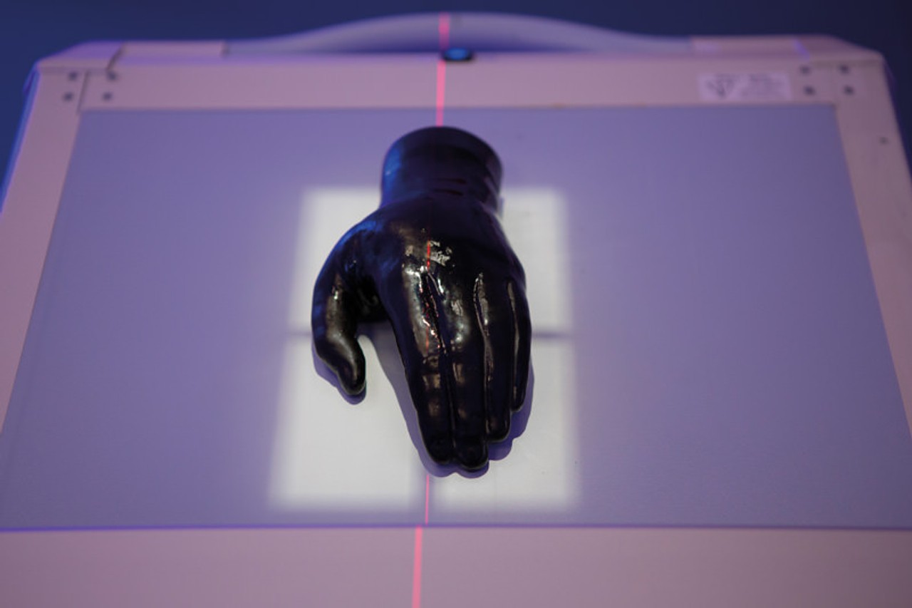 Hand Phantom for CT, X-Ray and Radiation Therapy