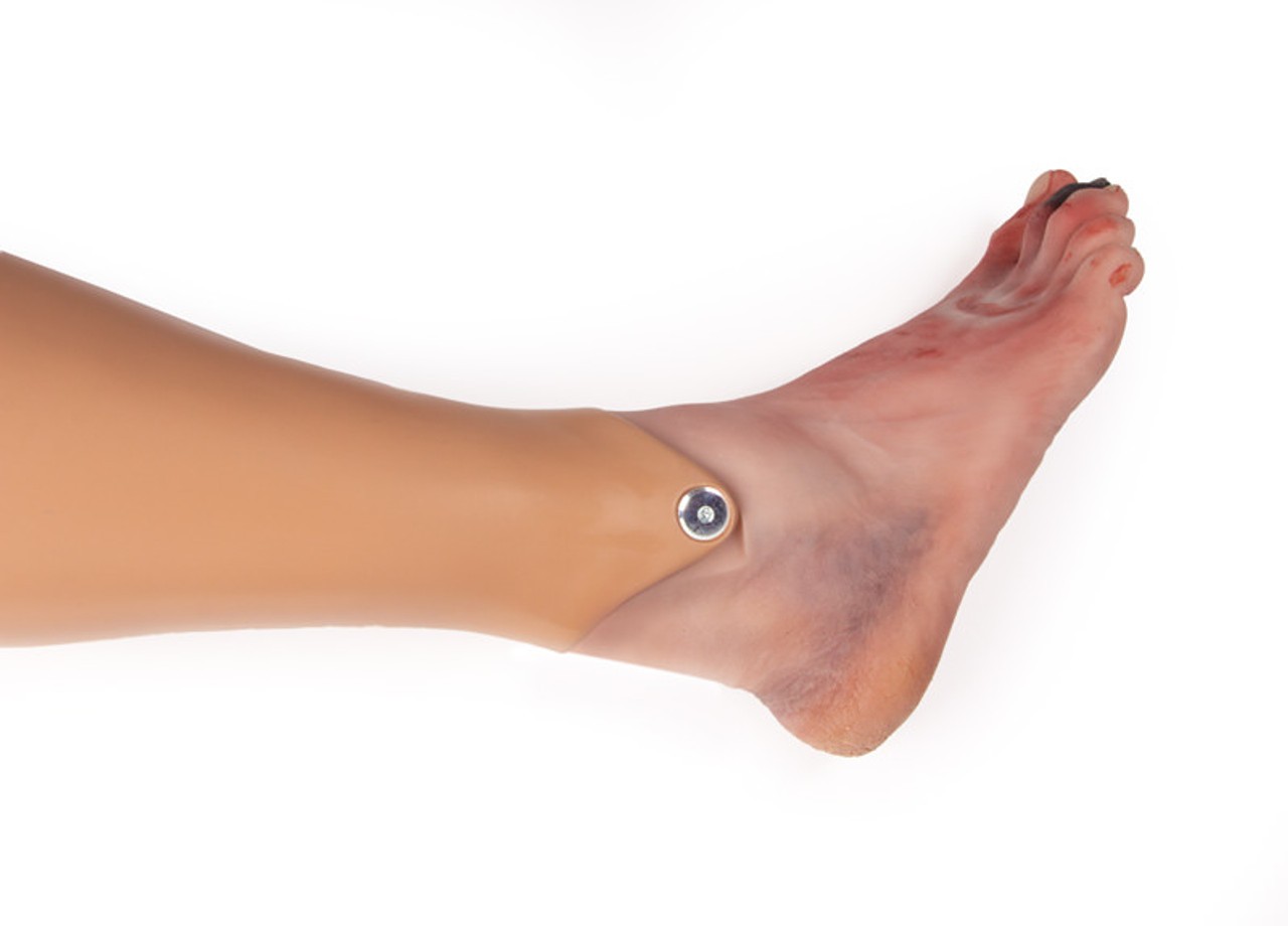 Wound Foot with Diabetic Foot Syndrome, Manikin Version