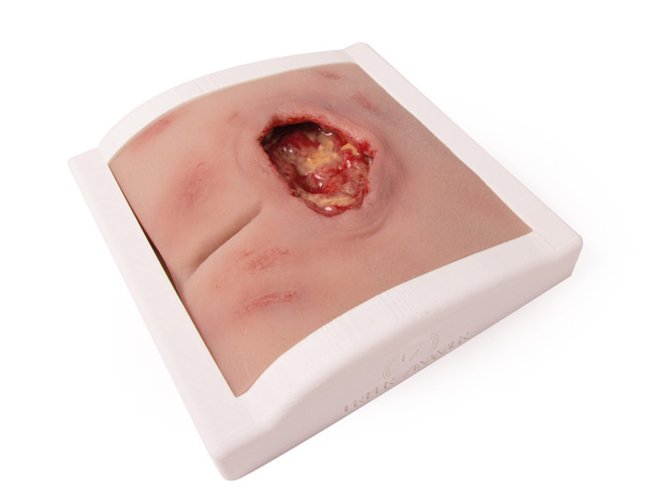 Wound Moulage Sacral Decubitus, Cleaned Including Stand