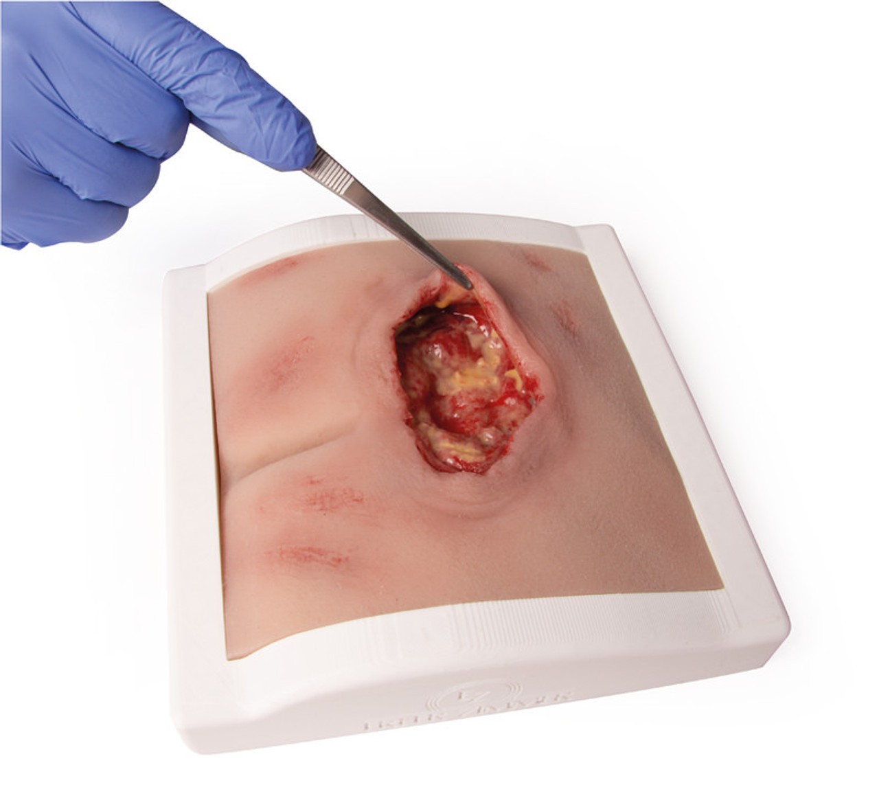Wound Moulage Sacral Decubitus, Cleaned Including Stand