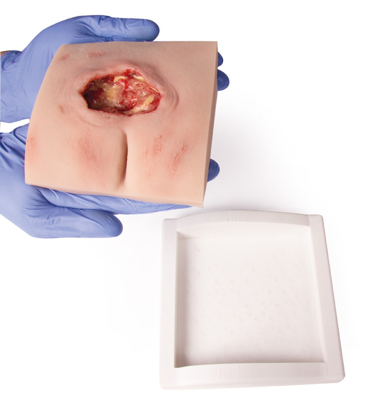 Wound Moulage Sacral Decubitus, Cleaned Including Stand