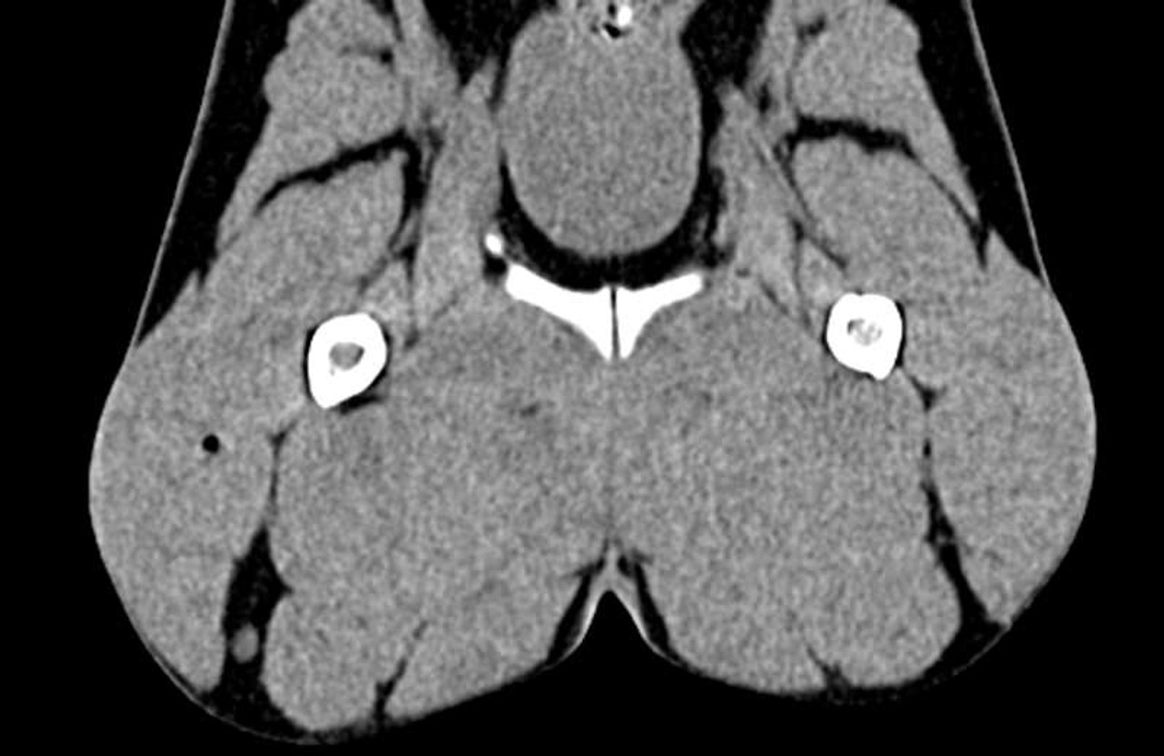 Dog Pelvis Phantom for CT and X-Ray