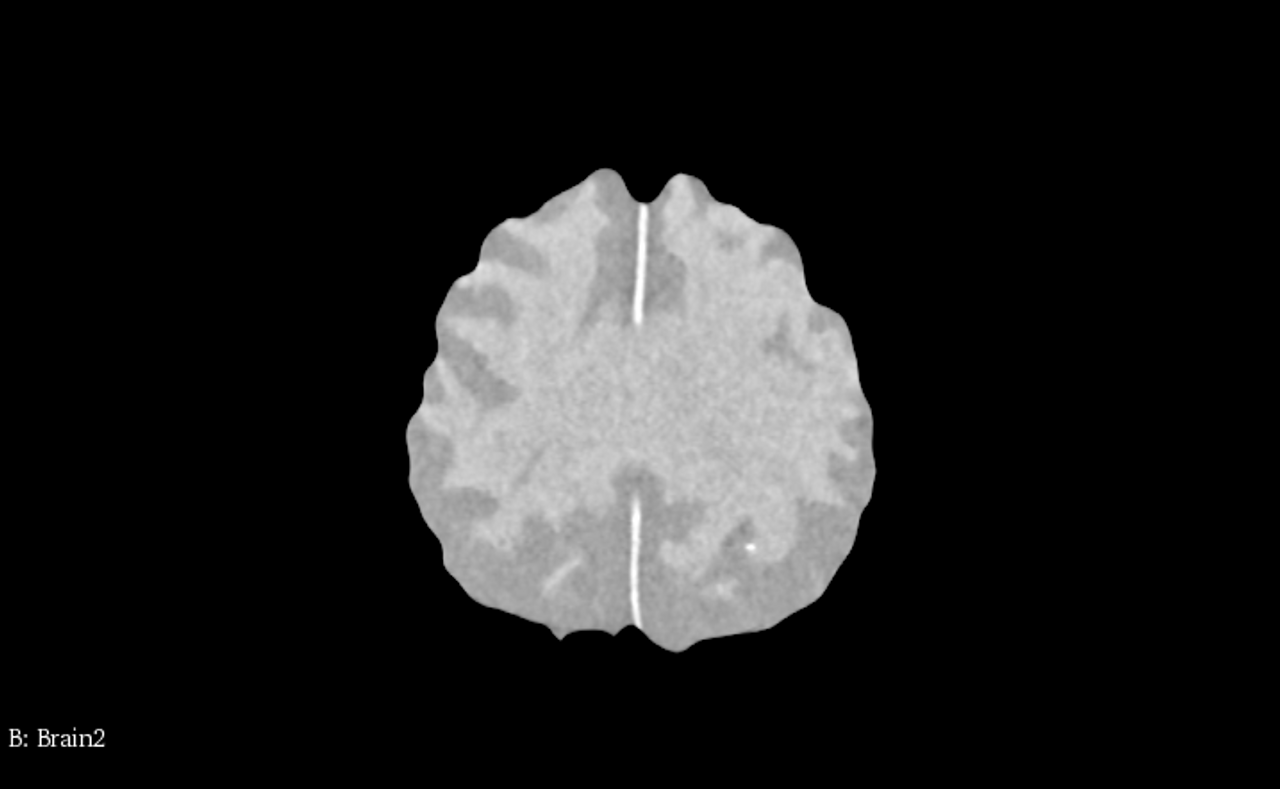 Basic Adult Brain Phantom Model - CT Scans