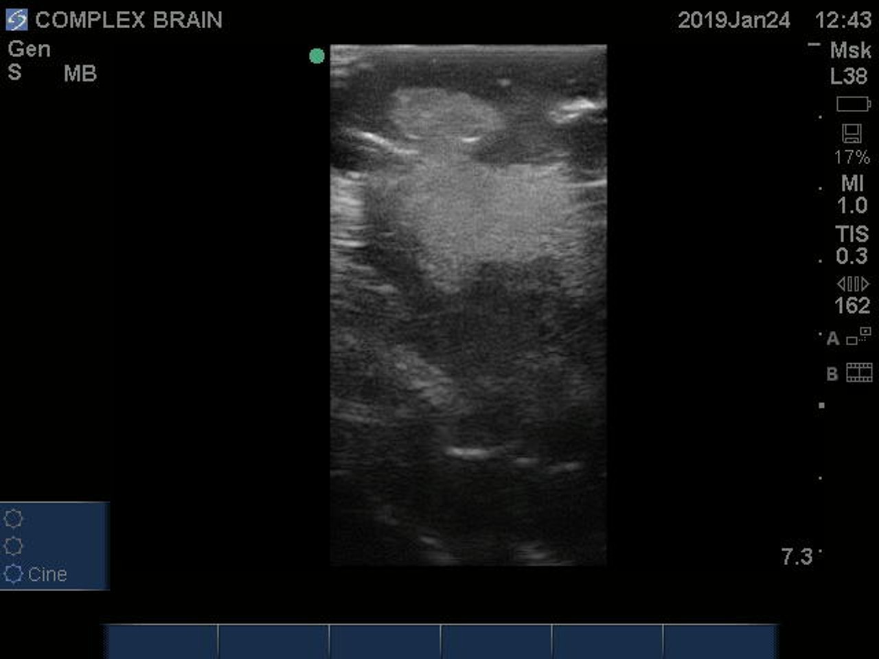 Basic Adult Brain Phantom Model - Ultrasound Scans