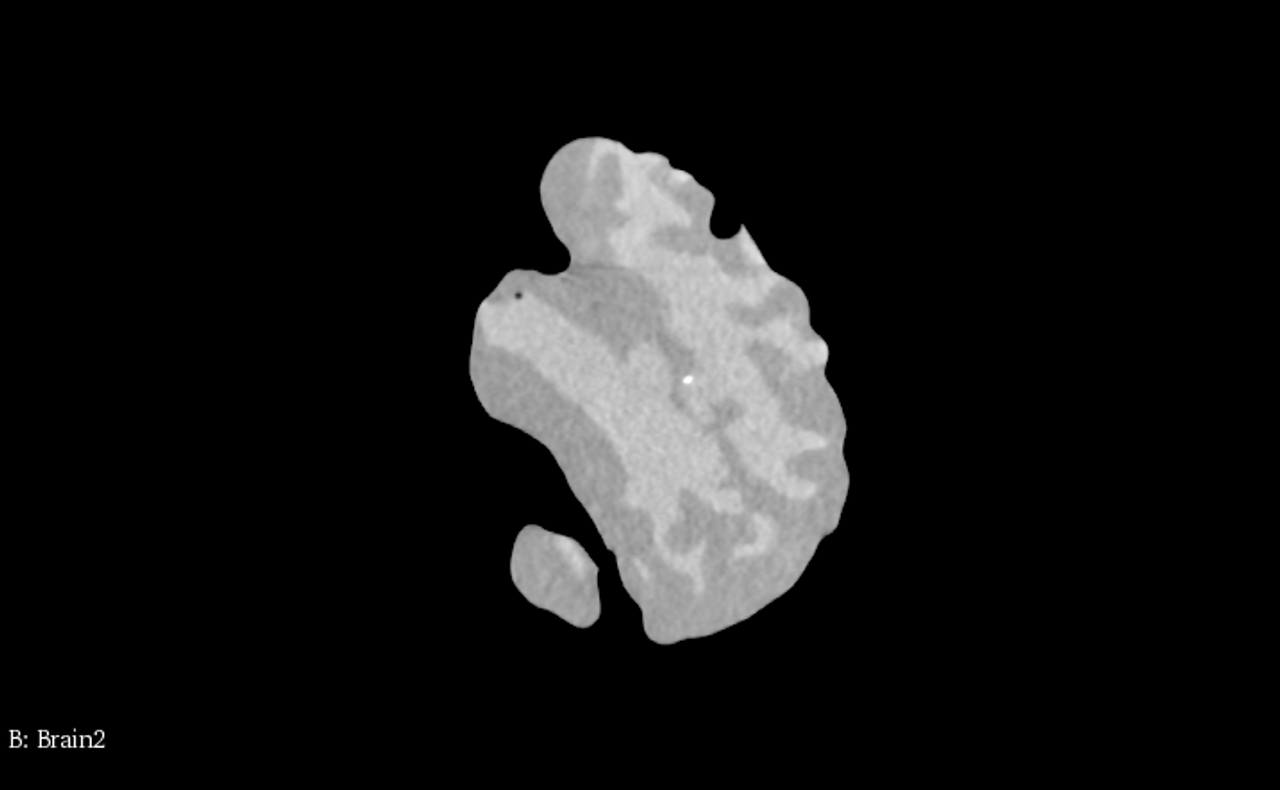 Basic Adult Brain Phantom Model - CT Scans