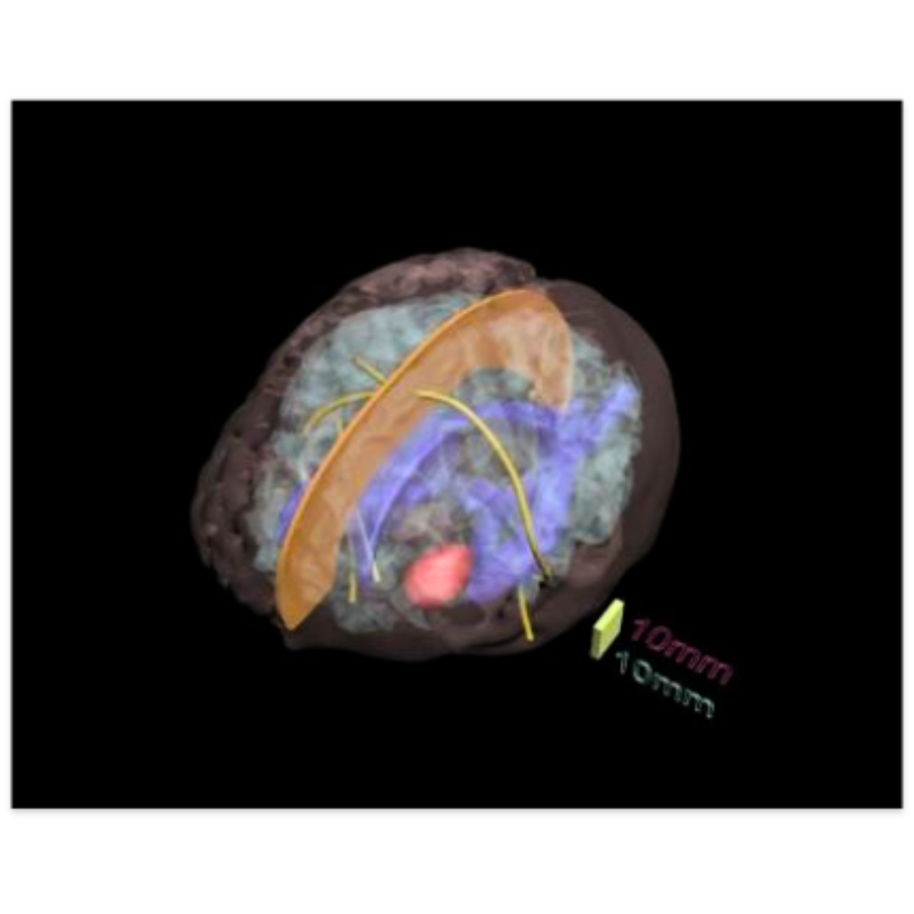 Adult Head X-Ray/CT and MRI Training Phantom Model