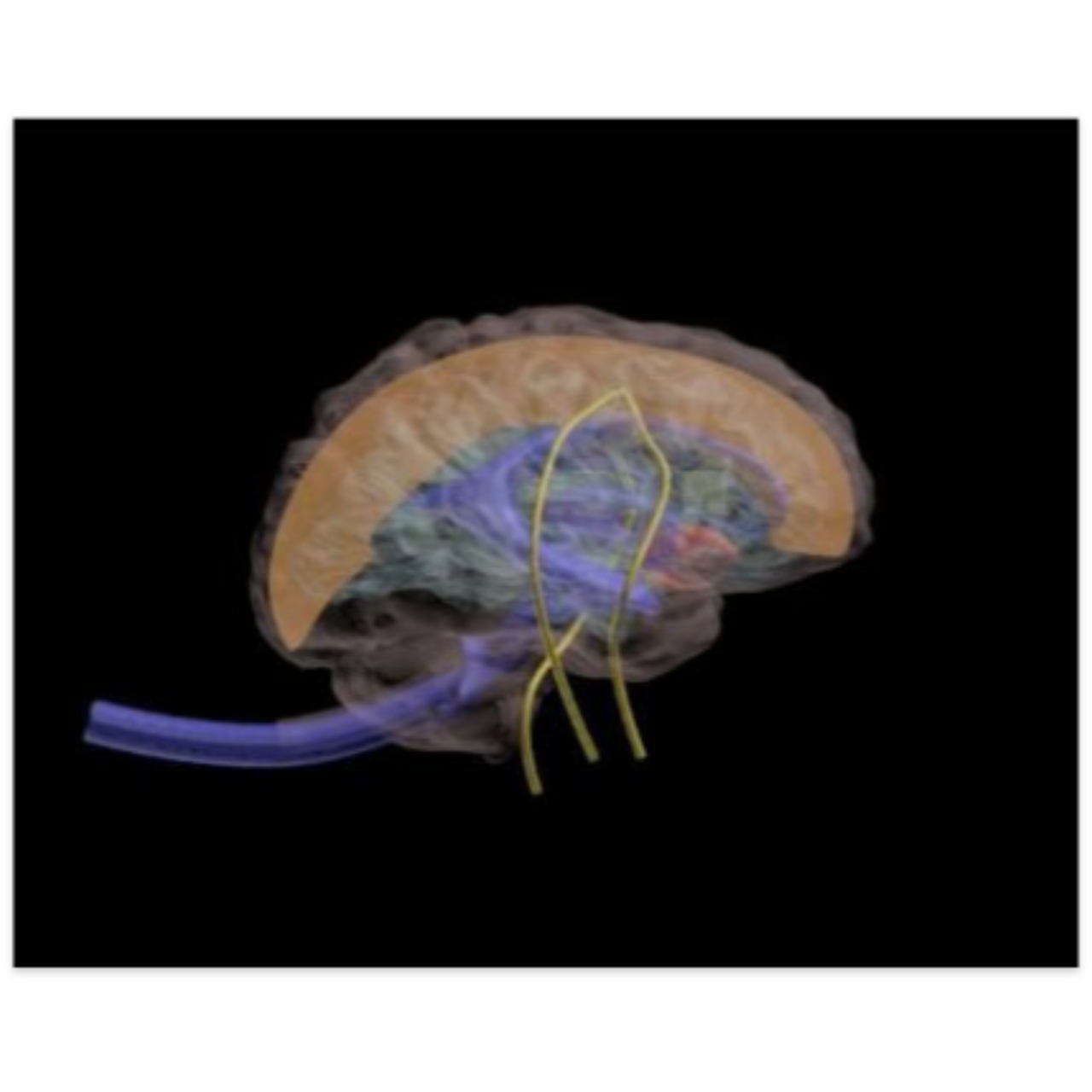Adult Head X-Ray/CT and MRI Training Phantom Model