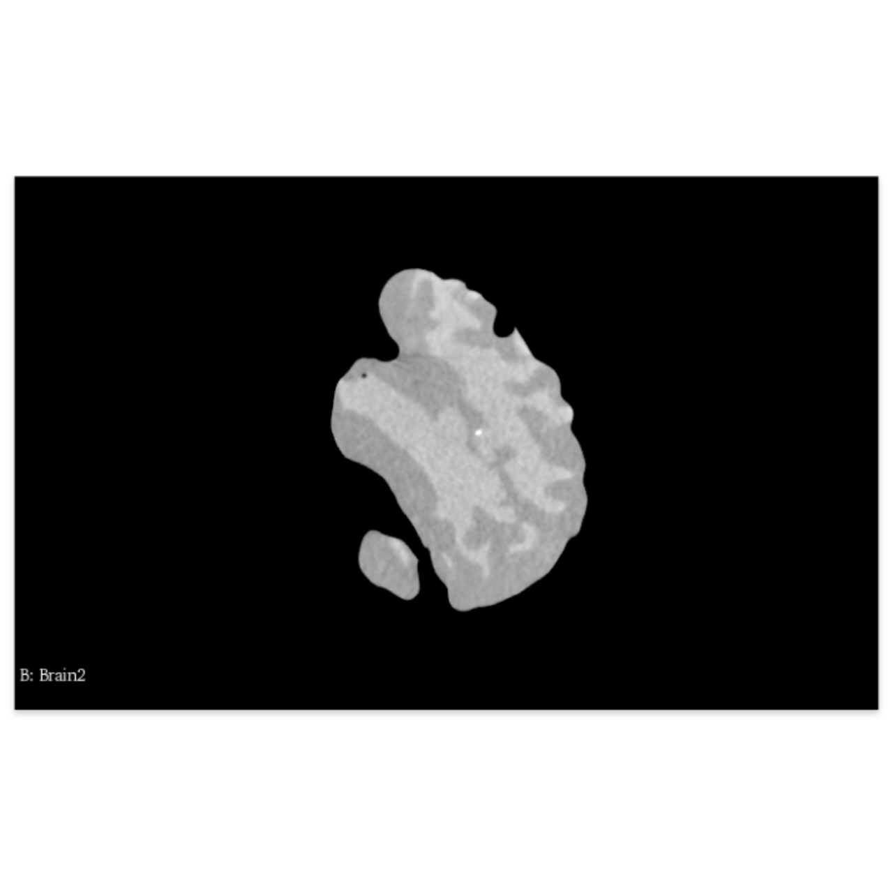 Adult Head X-Ray/CT and MRI Training Phantom Model - CT Scans
