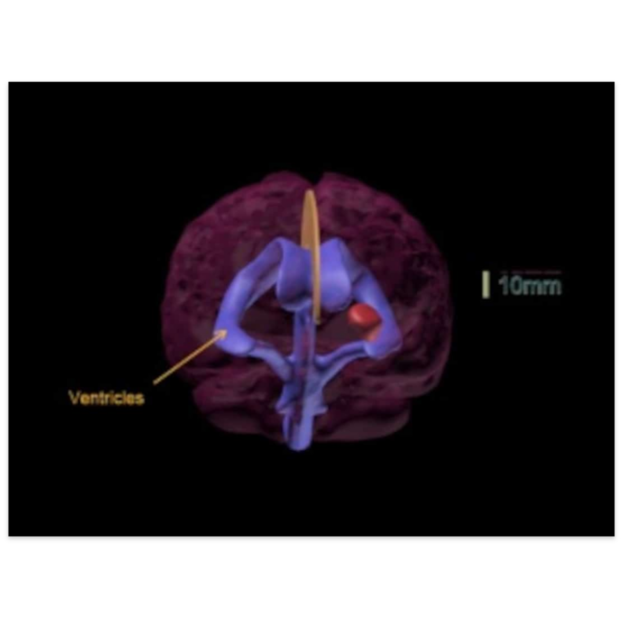 Standard Adult Brain Phantom Model