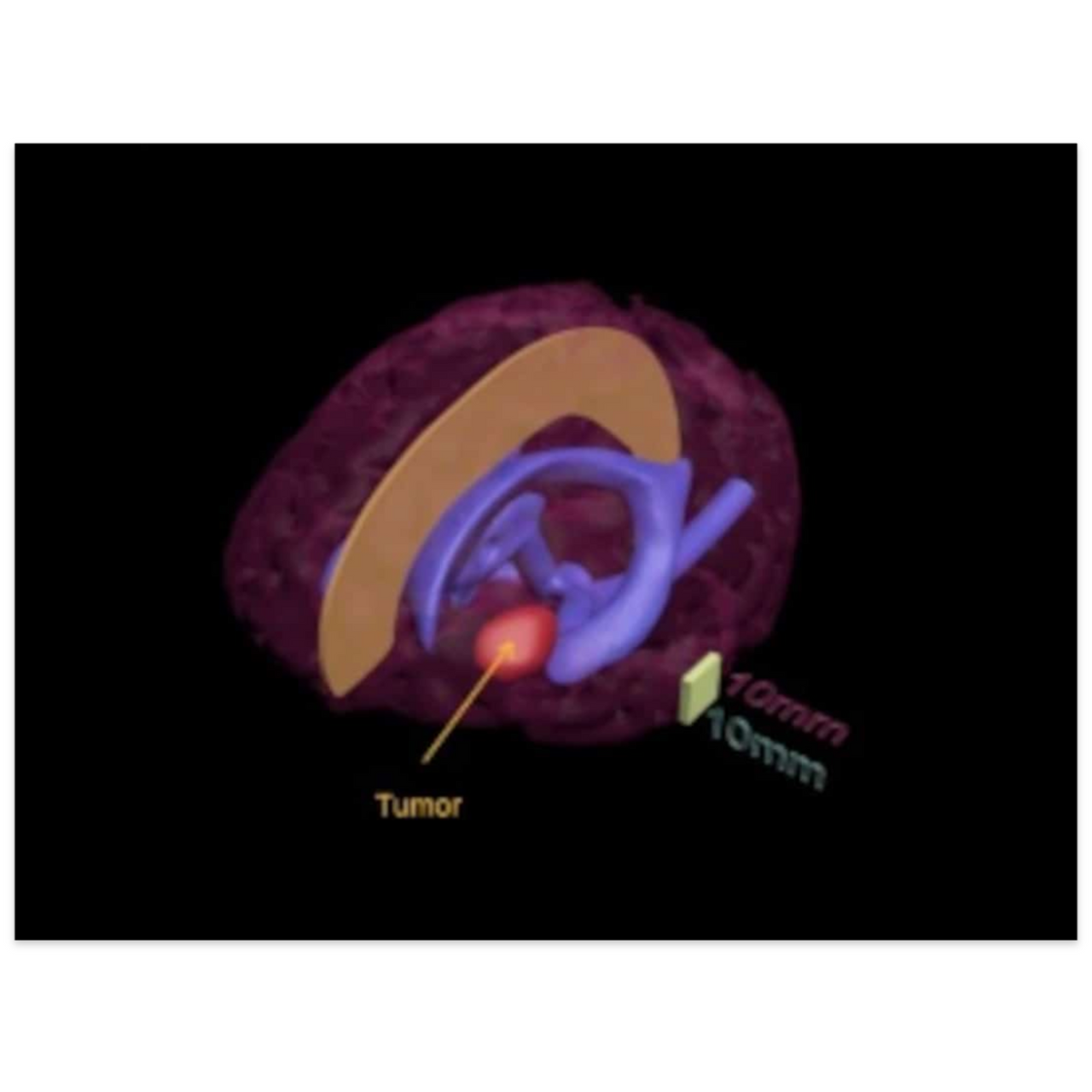 Standard Adult Brain Phantom Model
