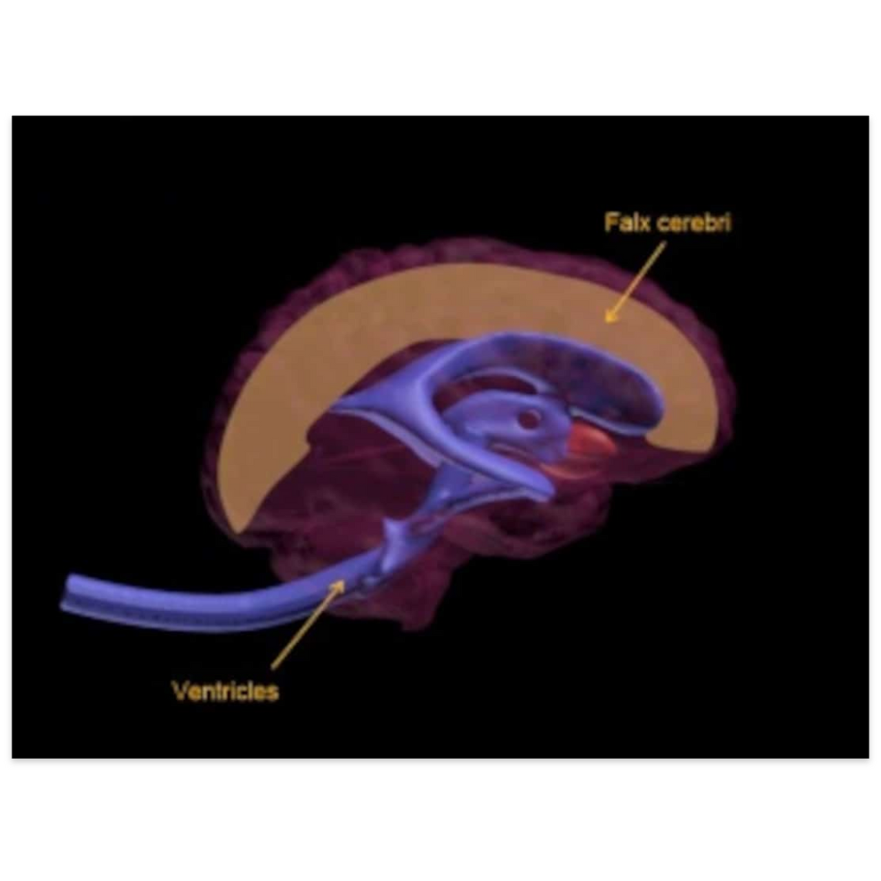 Standard Adult Brain Phantom Model