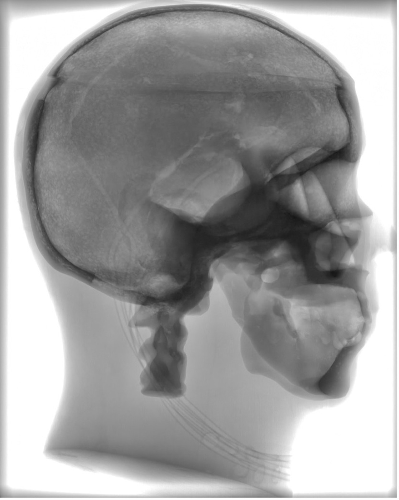 Standard Adult Head Phantom Model - X-Ray Scans